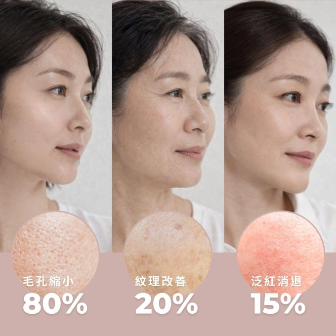 有肌泌語｜iPSC超泌體再生精華 7+3 日組 縮圖 4